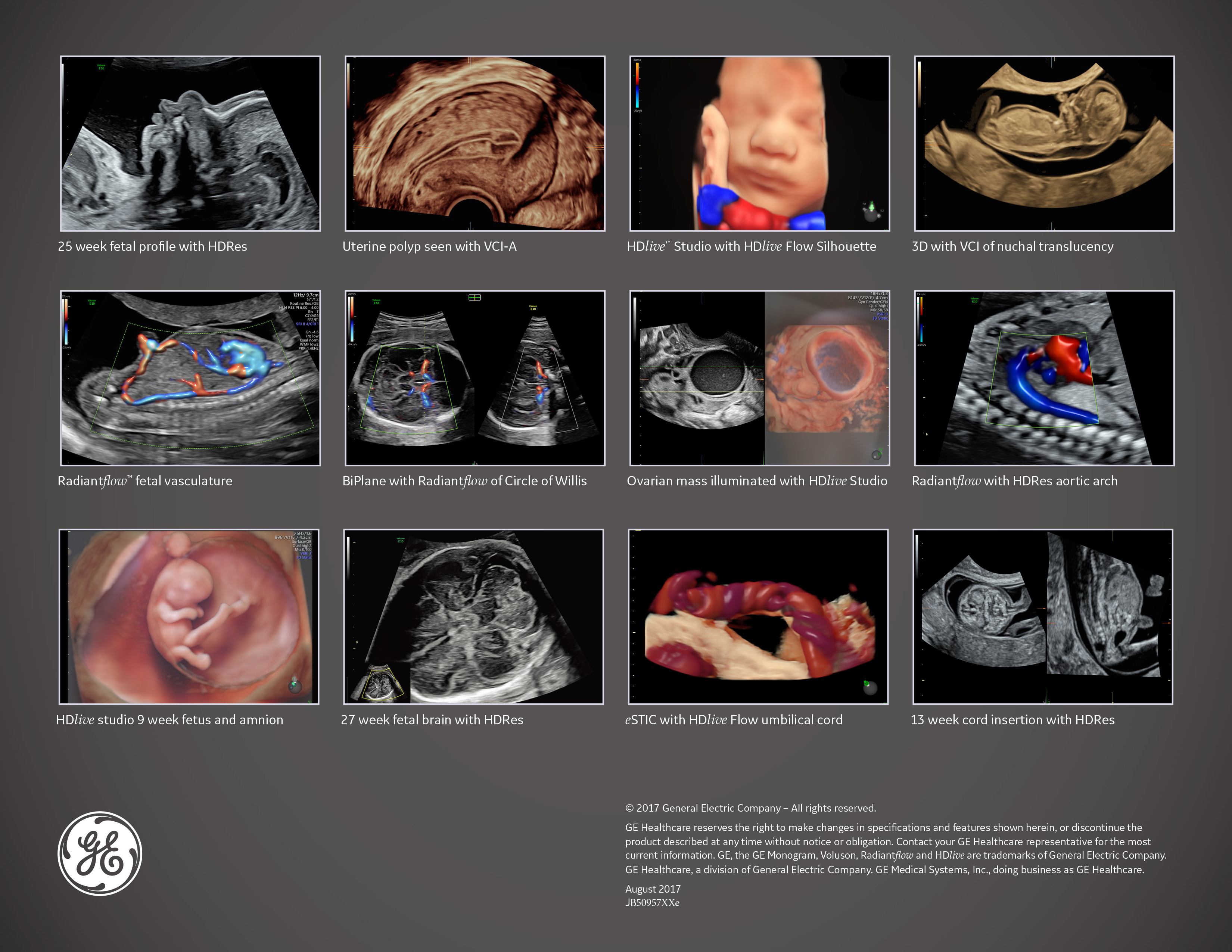 SunZoom Technology Co.LtdGE Ultrasound